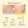Medicube Kojic Acid Turmeric Brightening Gel Mask 4 Stück