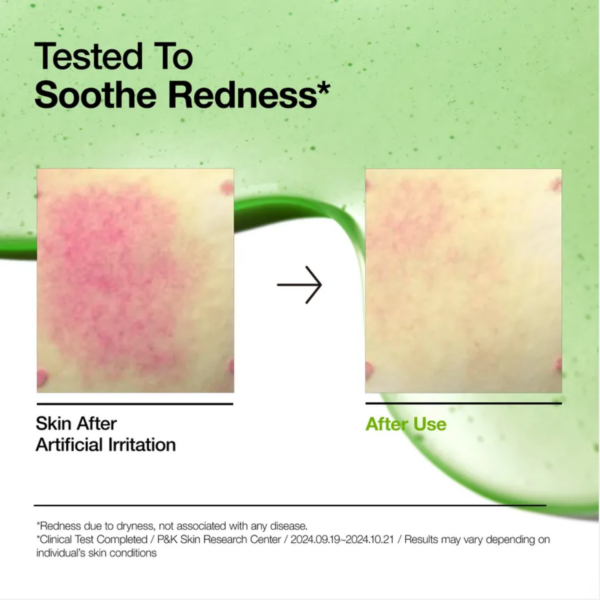 Anua Azelaic Acid 10 Hyaluron Redness Soothing Serum – Produktansicht 7