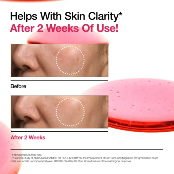 Anua Niacinamide 10%+TXA 4% Serum Anua Niacinamide 10%+TXA 4% Serum