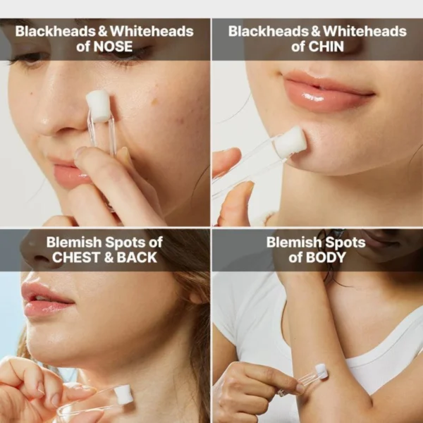 COSRX The AHA 2 BHA 2 Blemish Treatment Serum 50g COSRX The AHA 2 BHA 2 Blemish Treatment Serum 50g