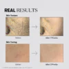 VT Cosmetics TX-Toning Daily Mask