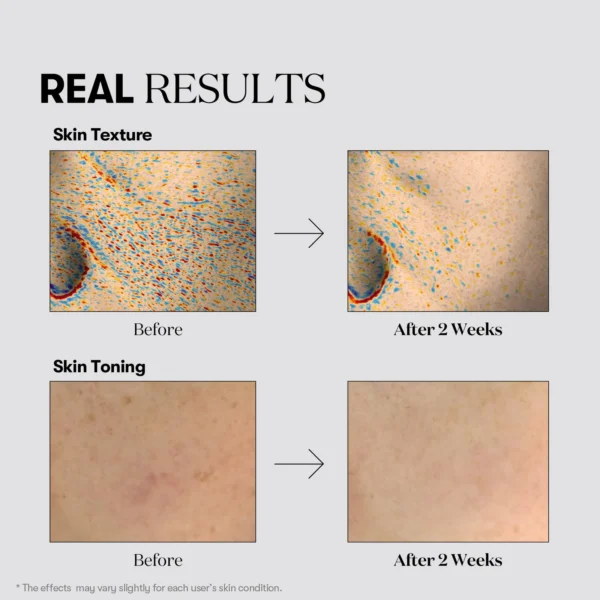 VT Cosmetics TX-Toning Daily Mask
