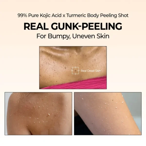 Dr. Melaxin Peel Shot Exfoliating Kojic Acid Turmeric Spray - Körperpeeling Spray 200ml Dr. Melaxin Peel Shot Exfoliating Kojic Acid Turmeric Spray - Körperpeeling Spray 200ml