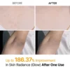 Dr. Melaxin Peel Shot Exfoliating Kojic Acid Turmeric Spray - Körperpeeling Spray 200ml Dr. Melaxin Peel Shot Exfoliating Kojic Acid Turmeric Spray - Körperpeeling Spray 200ml