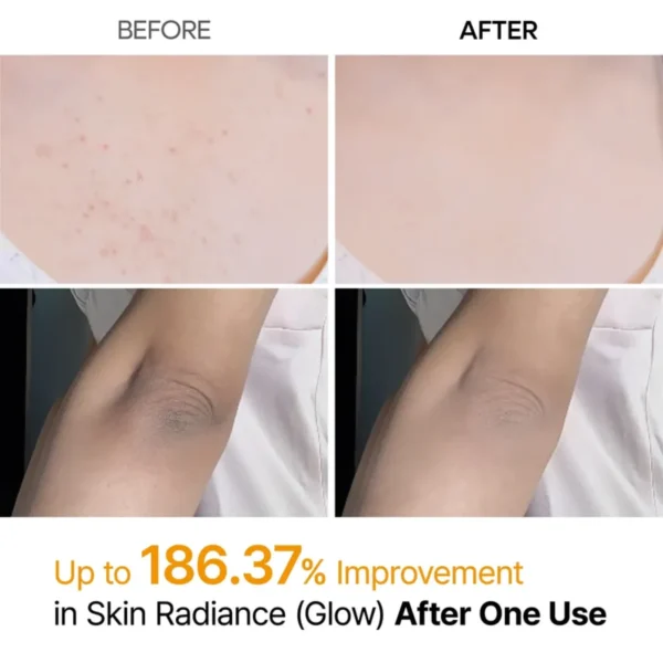 Dr. Melaxin Peel Shot Exfoliating Kojic Acid Turmeric Spray - Körperpeeling Spray 200ml Dr. Melaxin Peel Shot Exfoliating Kojic Acid Turmeric Spray - Körperpeeling Spray 200ml