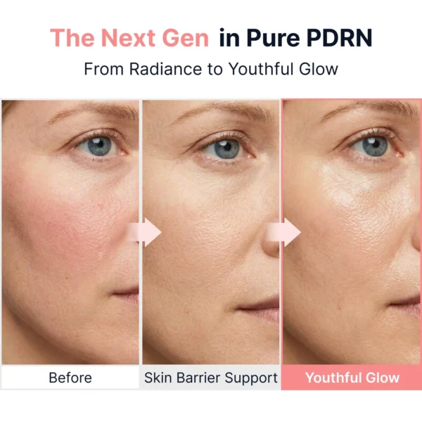 Sungboon Editor PDRN Pink Vitamin Glow Boosting Ampoule 40ml Sungboon Editor PDRN Pink Vitamin Glow Boosting Ampoule 40ml