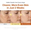 Sungboon Editor Kojic Acid Niacinamide Brightening Ampoule 40ml